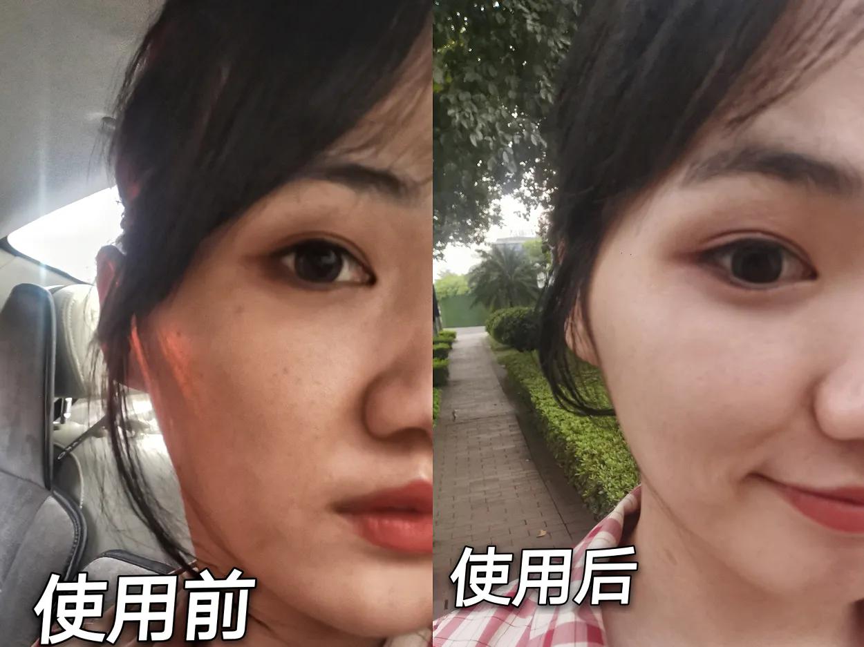 夏季干皮补水哪个牌子好,40岁混干皮夏季适合什么护肤品