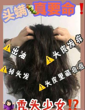 头油头痒还长小疙瘩用什么洗发水,头皮下长虫用什么药治疗