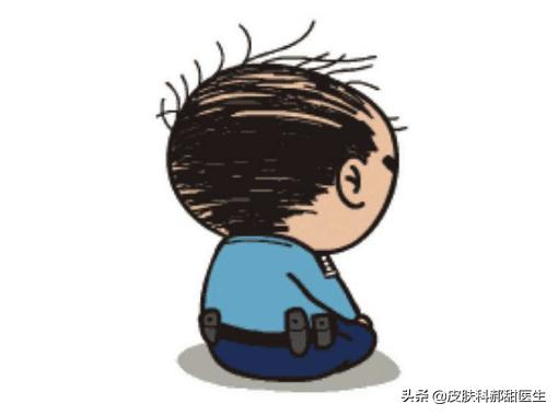 脱发吃非那雄胺要一直吃吗,脱发一定要吃非那雄胺片