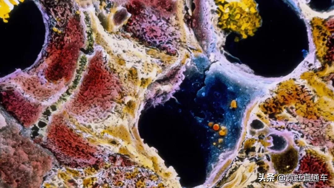 试述pbc与psc的鉴别诊断要点,ps疑难杂症