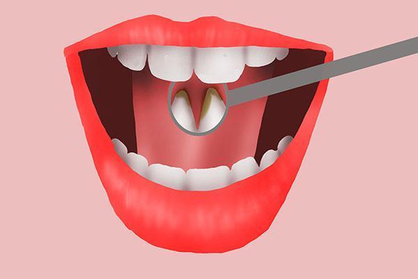 补牙是种植牙还是烤瓷牙好,缺牙修复用烤瓷牙还是种植牙