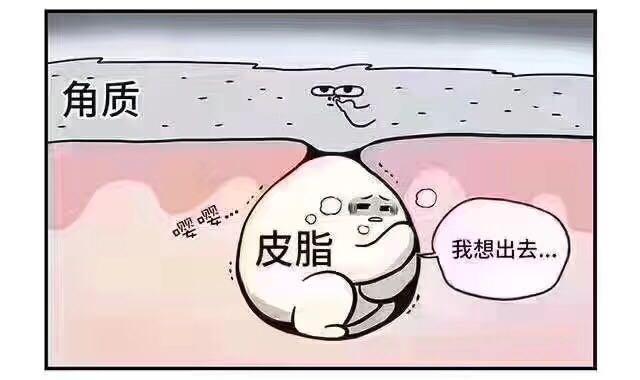 脸颊两侧长闭口怎么消除,脸颊闭口怎么消除