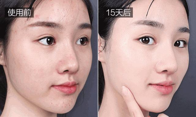 美白祛黄提亮肤色泡水喝,每天喝一杯可以美白淡斑清热解毒