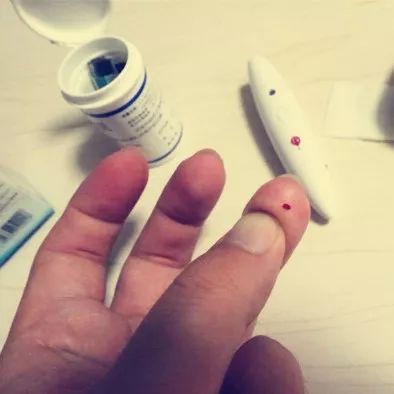 宝宝末梢血从哪里采集,婴幼儿采集静脉血的方法