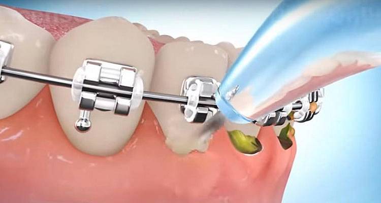 春季唇妆,唇妆不好看