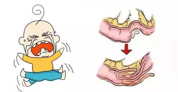 小孩闹肚子呕吐怎么回事,小孩一哭闹就呕吐是怎么回事