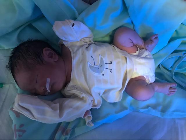 胎儿38了可以去剖了嘛,孕38周剖好不好