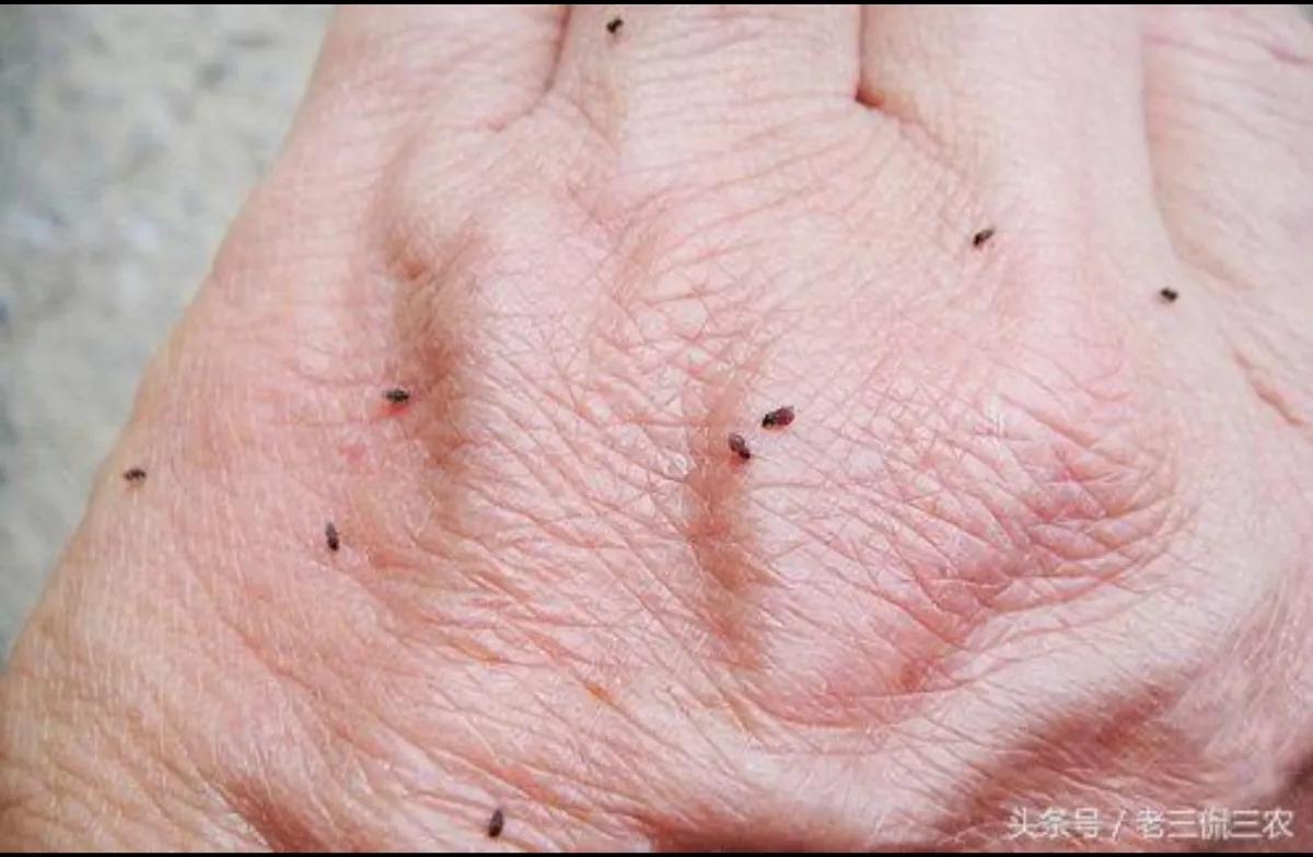 被墨蚊咬了身上全是小红点,被墨蚊子咬了怎样治疗