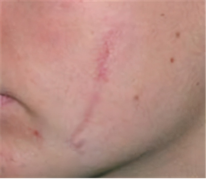 试试、看看、等等，算命式医生害死人：乡镇就医三原则