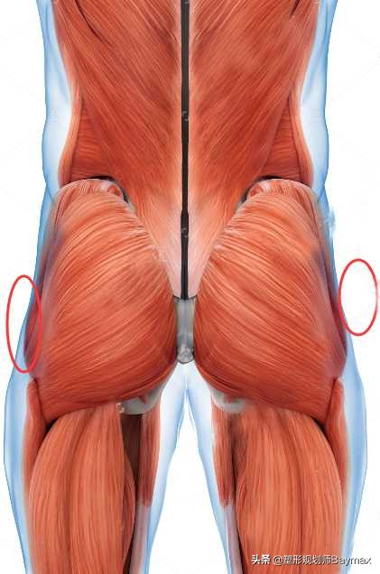 改善臀部两侧凹陷最有效方法负重,填补臀部凹陷大腿要外旋还是内旋
