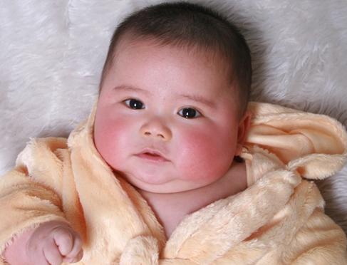 1岁男宝反复湿疹怎么办,11岁儿童湿疹是脾胃虚弱的原因吗