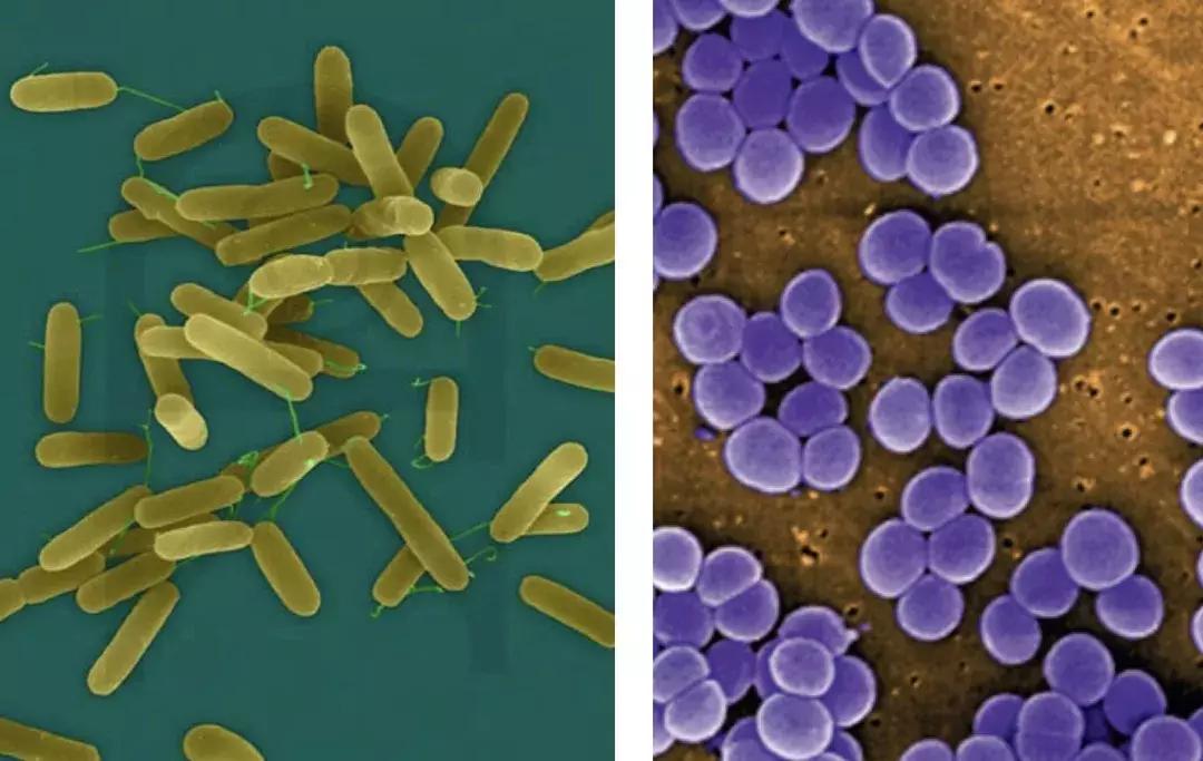 感染性疾病主要检测流程,感染性疾病筛查怎么做