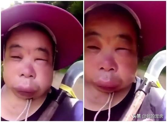 被蜜蜂蛰了一招解决,被蜜蜂蛰了怎么办小技巧