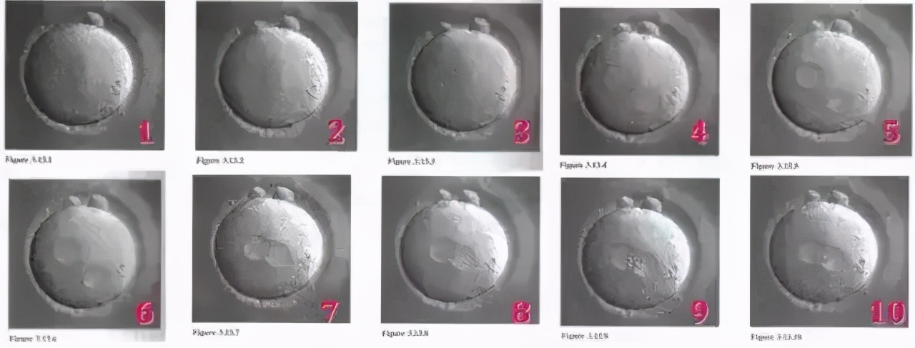 移植优质胚胎着床失败原因,质量差的胚胎为啥还要移植呢