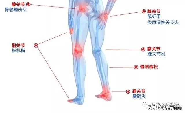 骨性关节炎诊疗指南2019解读,骨性关节炎的护理诊断和措施