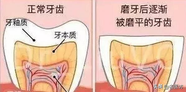 牙齿吃雪糕敏感怎么办,牙齿吃冰的就特别敏感怎么办
