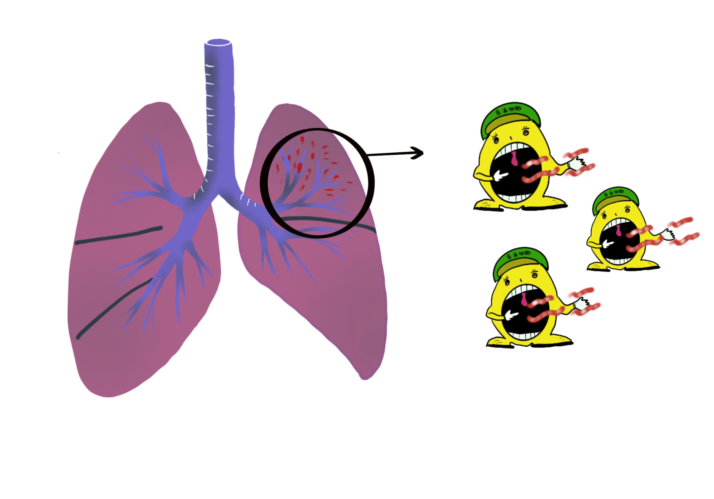 世界防治结核病日历史,世界结核病日来历
