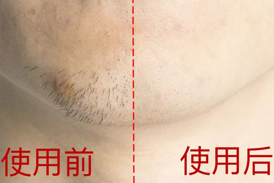 小米剃须界的黑科技,小米飞利浦剃须刀