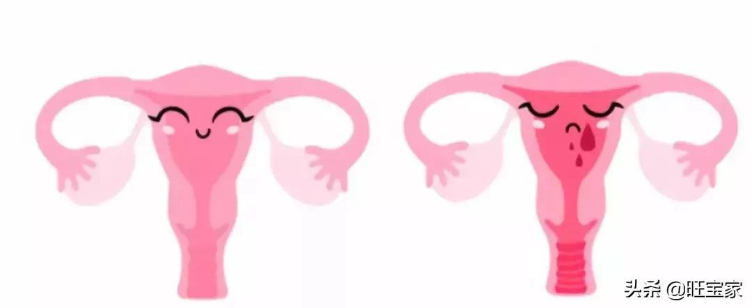 小产坐月子是天方夜谭?小产的这些事儿你必须了解!