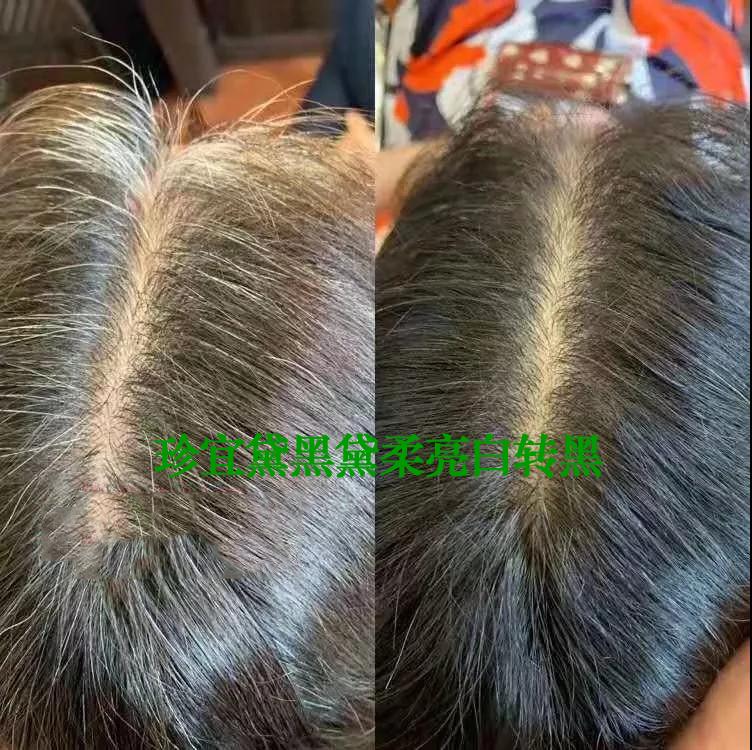 白发转黑视频成功案例,原始点白发转黑发案例