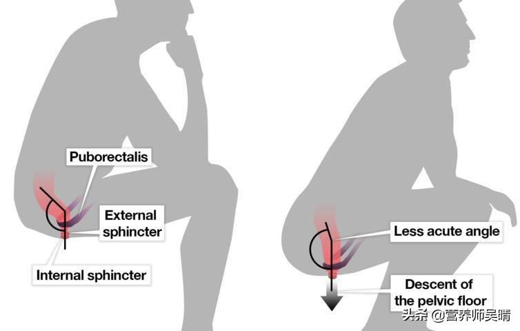 自从开始减肥后，我就便秘了！怎么办？
