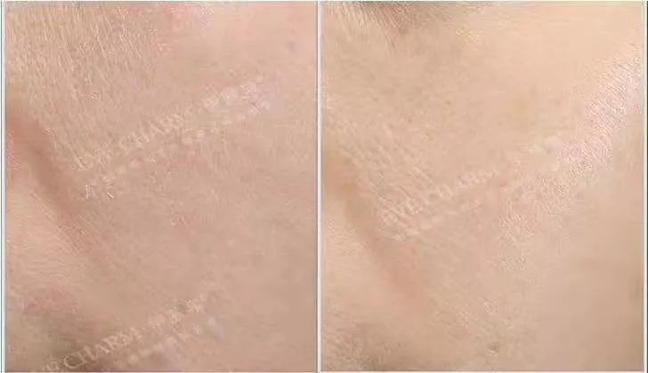 伊肤泉小白瓶新品发布,上市首月狂卖12000台