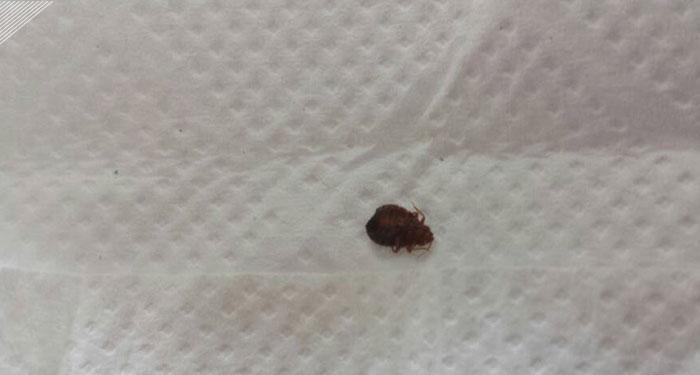 一觉醒来身上到处痒皮肤没有异样,一觉醒来身上刺痒是怎么回事