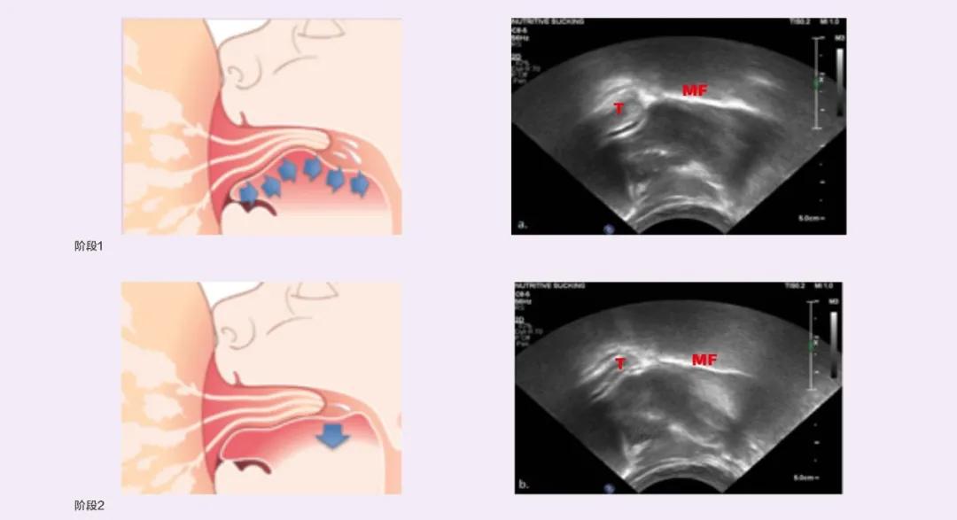 核心科技宠爱新一代妈妈，飞利浦新安怡创新定义SP*级A**泌乳体验