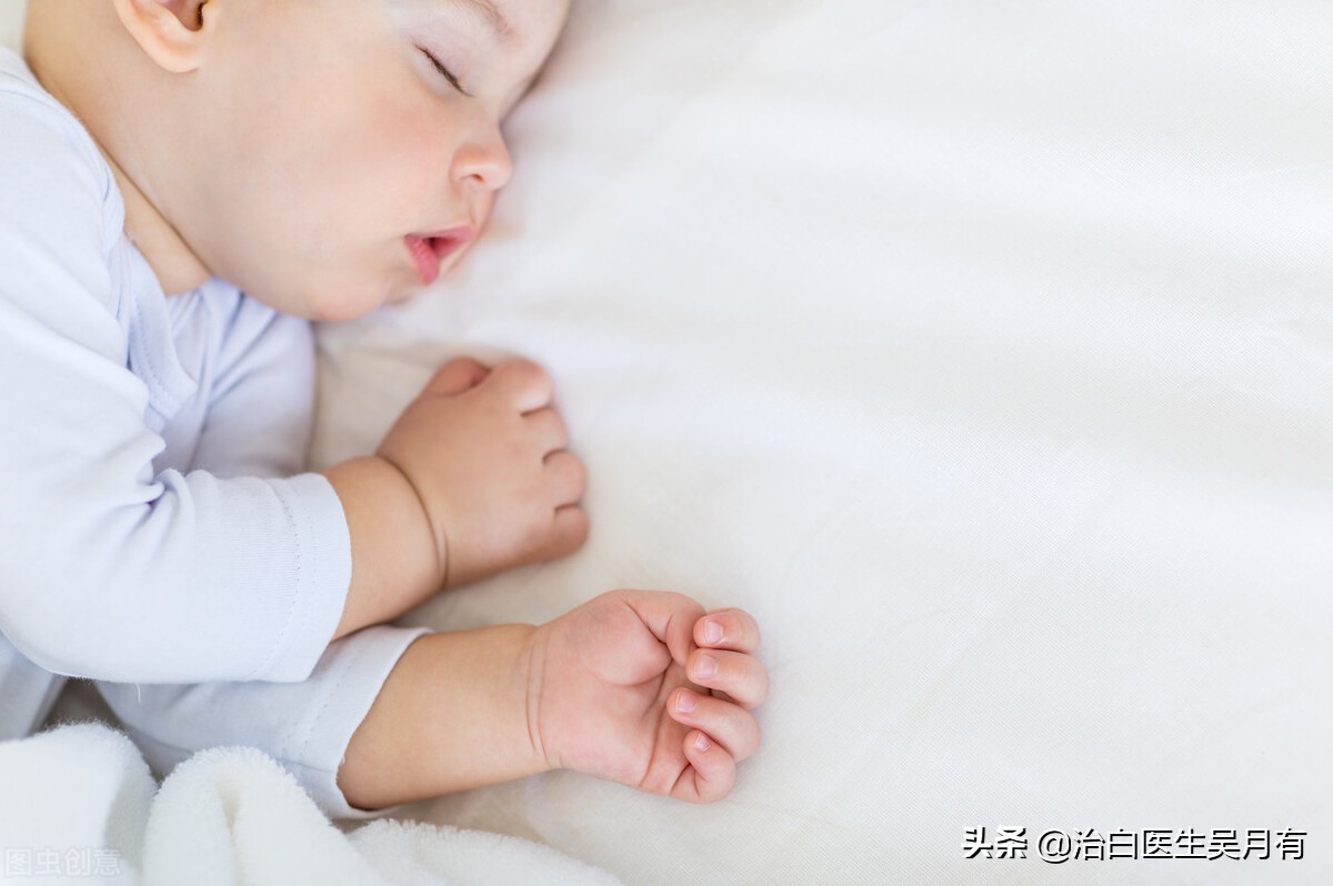 四个月宝宝手臂患有白癜风如何治疗?