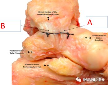 刚崴脚是要冷敷还是热敷,崴脚后24小时内是热敷还是冷敷