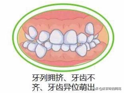小孩子常见牙齿问题有哪些,孩子牙齿出现问题该不该去医院