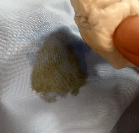 小孩衣服顽固污渍去除的最佳方法,哪种方法有助于清洗衣服上的污渍