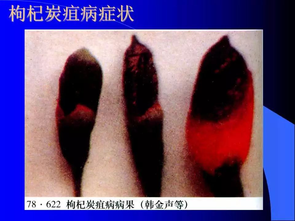 如何识别植物炭疽病和叶斑病,植物炭疽病的介绍