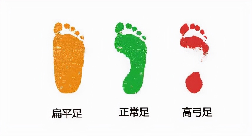 警惕高跟鞋给你带来的十大伤害,高跟鞋对脚有什么危害