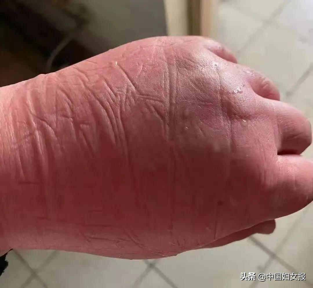 馒头手主人已找到,馒头手的主人都找到了吗