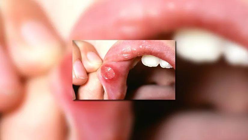 多吃能增加抵抗力吗,多吃一点是不是能增强体质