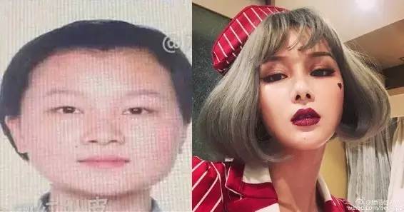 把水光针当饭吃？这位网红简直丧心病狂！整容后年入千万