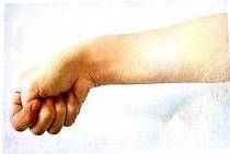 几个动作预防腱鞘炎(妈妈手),准妈妈必看