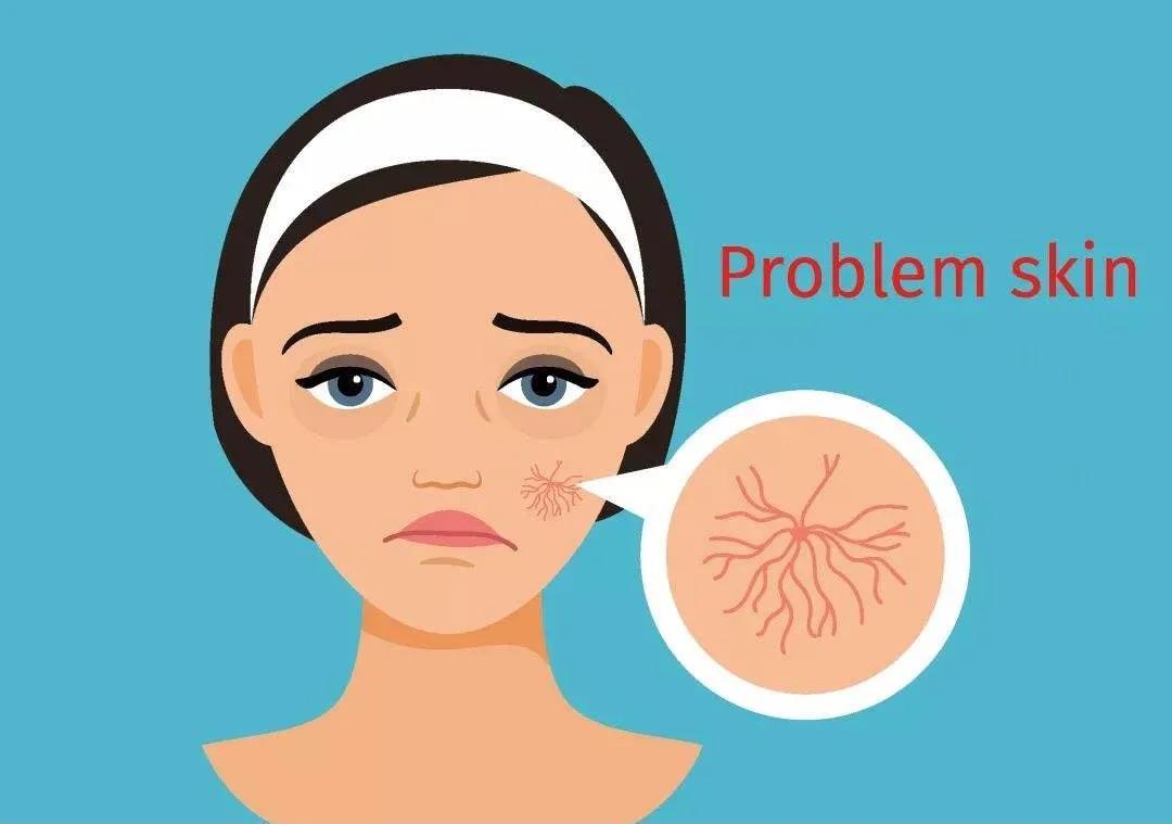 角质层被划破会感染狂犬吗,角质层破坏是皮肤屏障受损吗