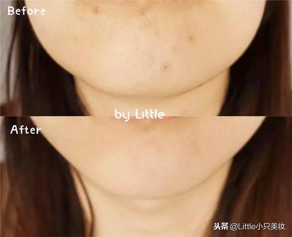 瘦脸提拉紧致美容仪什么牌子好,各类美容仪大测评