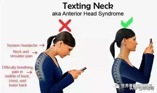 颈椎生理曲度反弓可以去健身房吗,颈椎病反弓原理