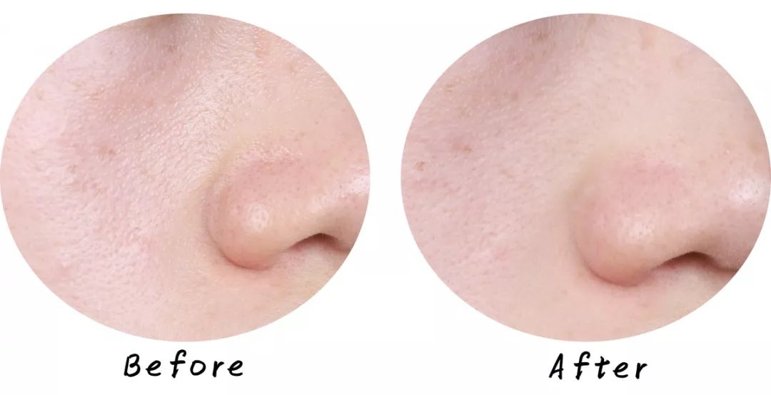 十大清洁面膜排行榜混合性皮肤,十大好用清洁面膜