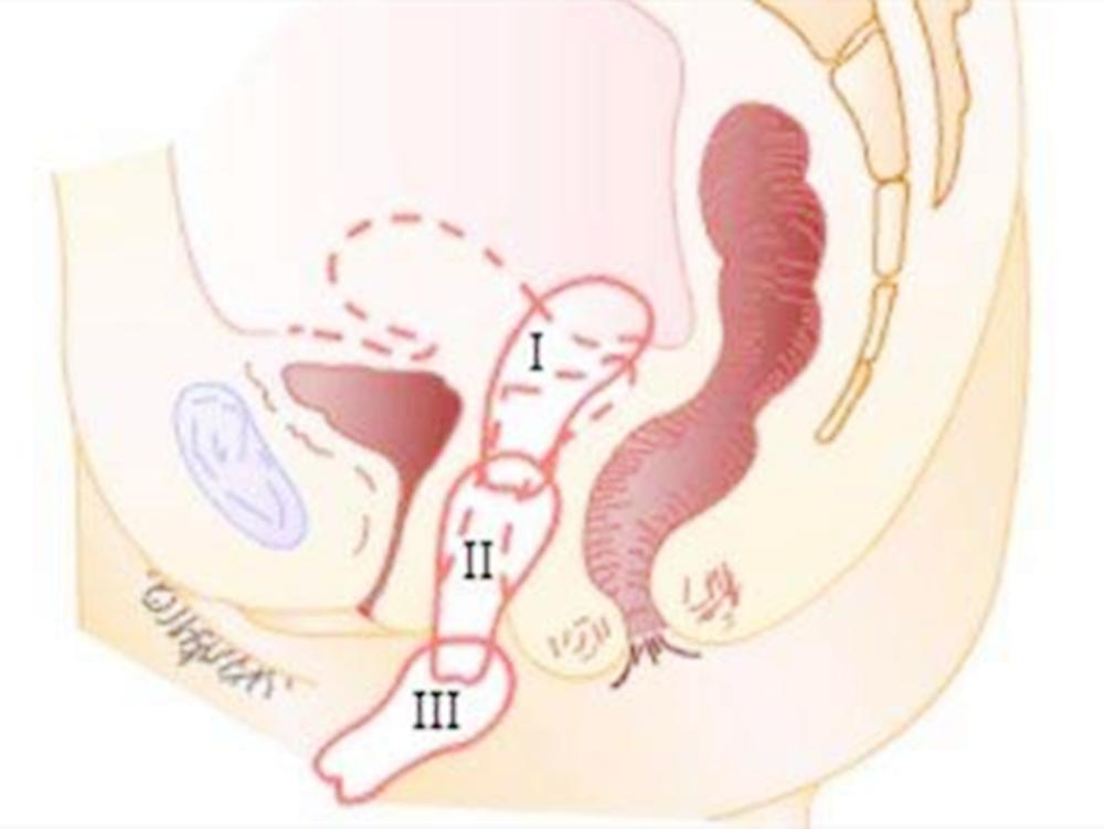 顺产后突然出现剧烈腹痛,宝妈生完孩子后腹部剧痛