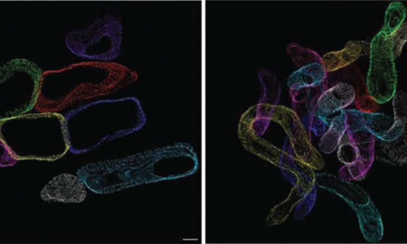 内脏脂肪对心脏的影响,心脏上脂肪太多有什么危害