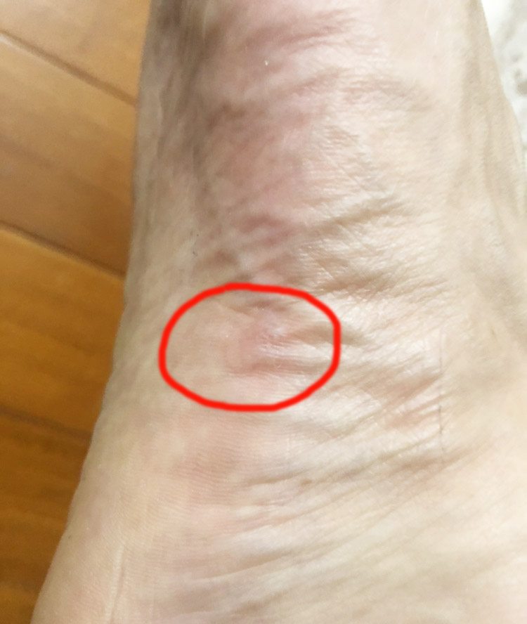 aj33容易崴脚吗,aj33易崴脚吗