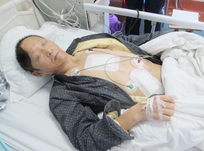 脑外伤开颅手术后脑积水,脑外伤手术后脑脊液鼻漏怎么治疗