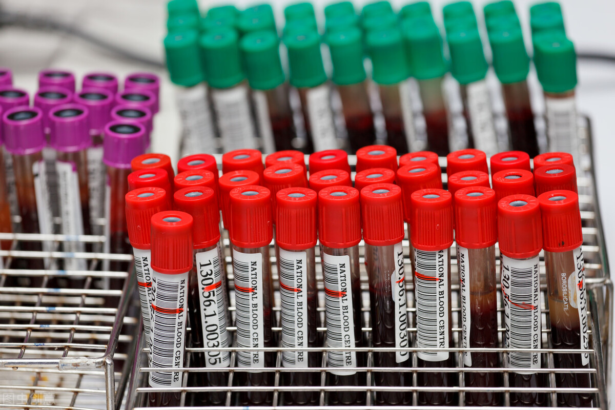 去医院看病为什么总是要抽血,去皮肤科看病要验血吗