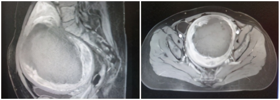 海扶刀的缺点是什么,海扶刀背后的真相视频