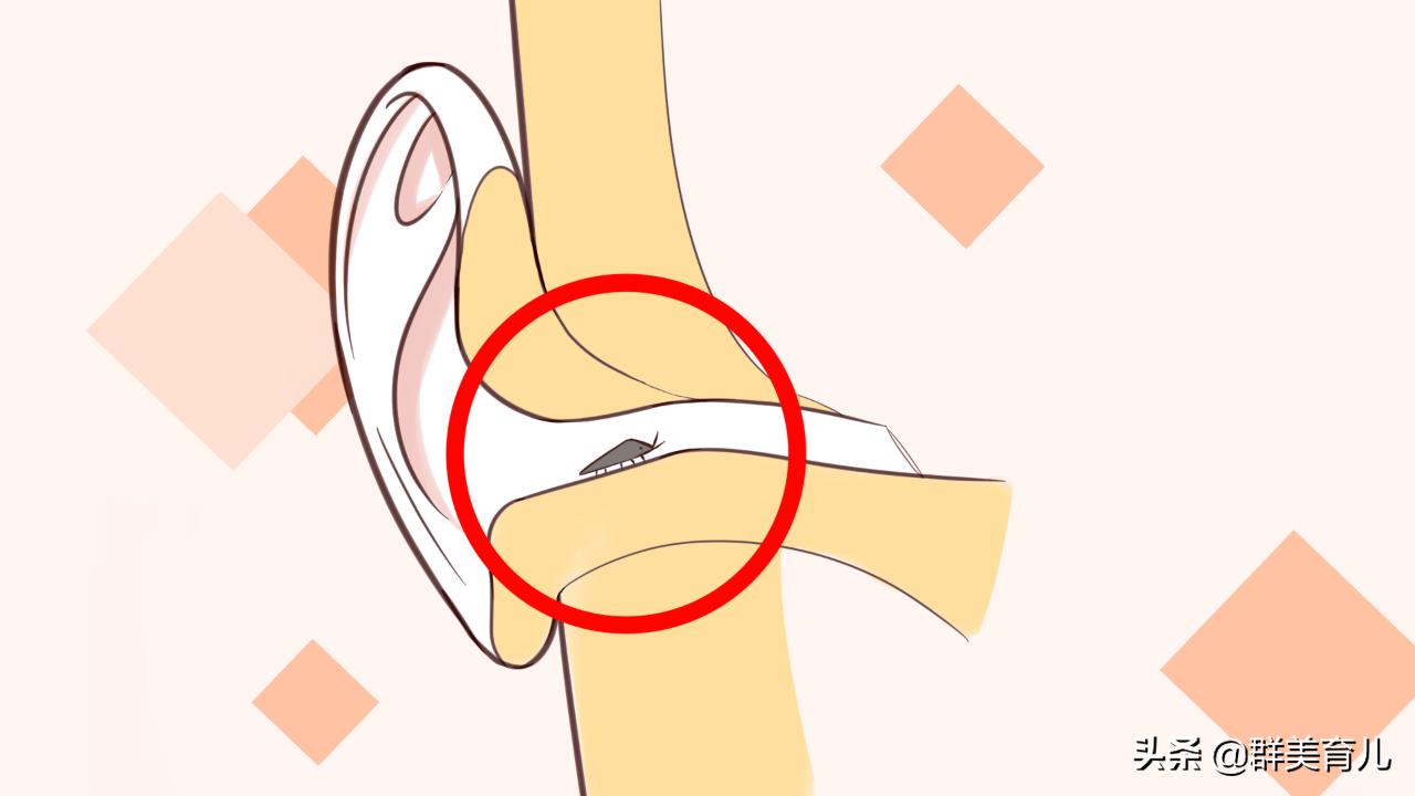 虫子飞进耳朵怎么办？5个小方法帮你搞定！实在不行再去医院