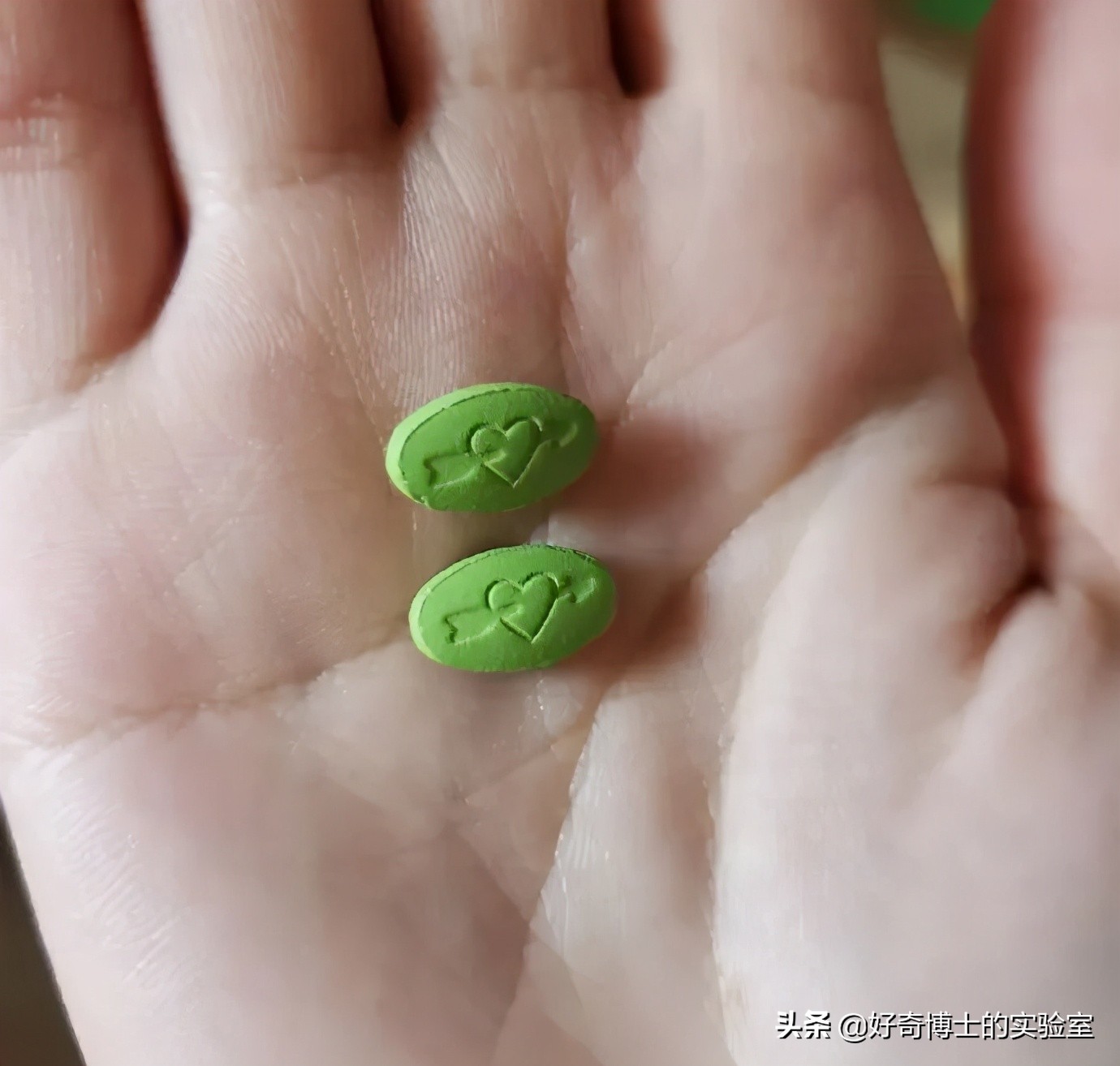 爱因斯坦的发型竟然是罕见病,爱因斯坦头发为什么总是乱糟糟的